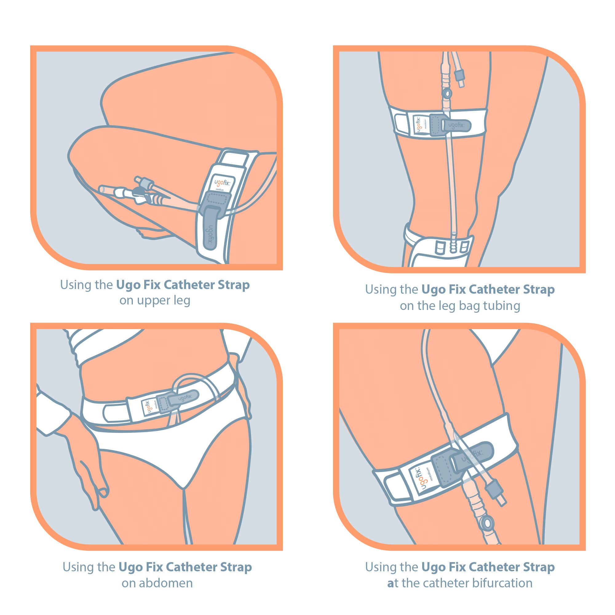 Ugo Fix Catheter Strap – Catheter Securement Strap (x5)