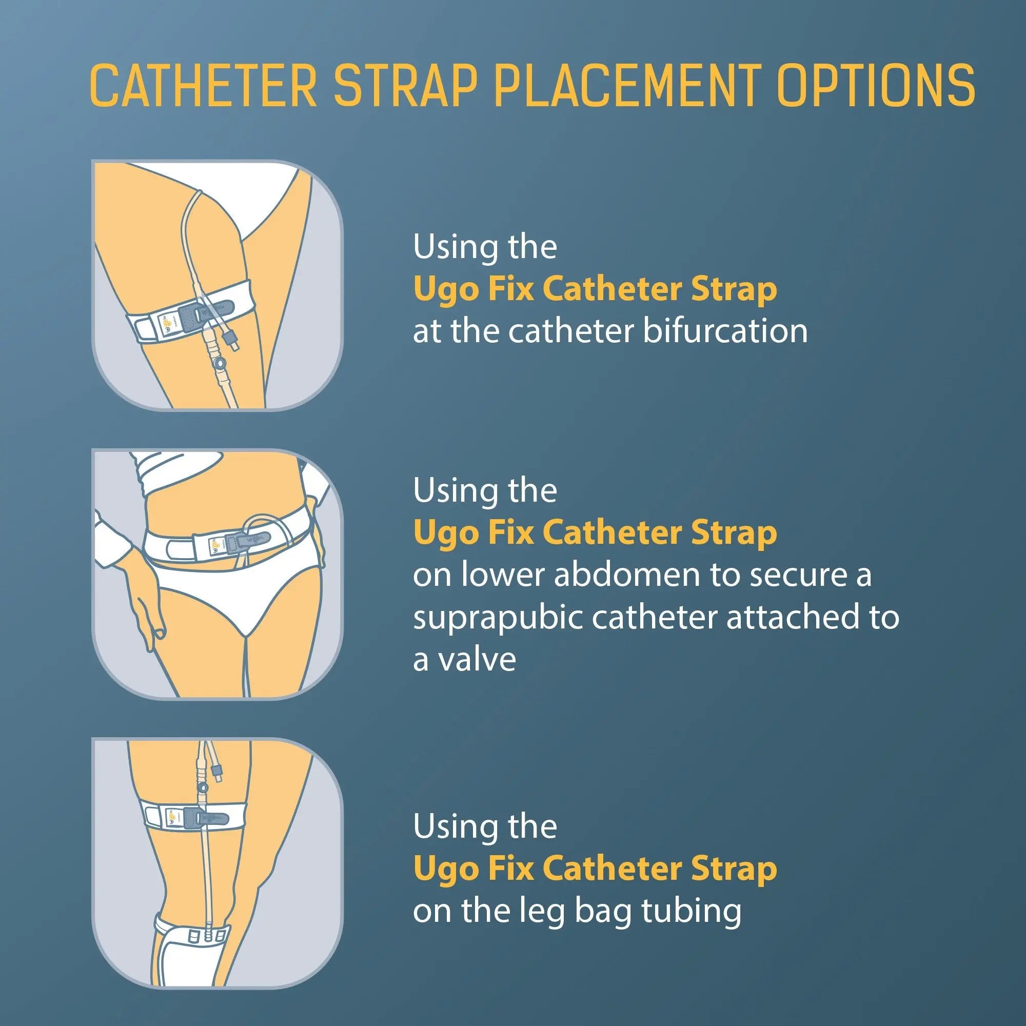 Ugo Fix Catheter Strap Catheter Securement Strap (x5)